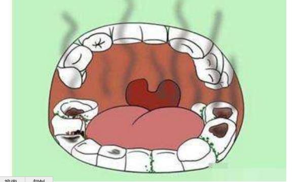 幽门螺杆菌最怕的食物卷心菜，坚持吃，胃病不攻自破！