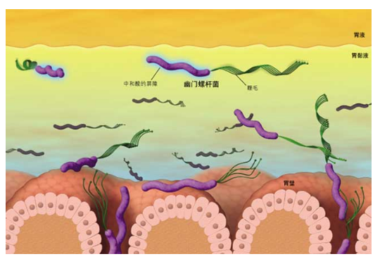 幽门螺杆菌是怎么产生的，它是从哪里来的呢