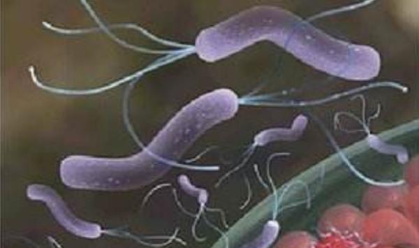 幽门螺杆菌检测数值范围，得了幽门螺旋杆菌应当怎么办？