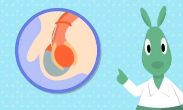 新生儿鞘膜积液是什么原因造成的？要怎么治疗！