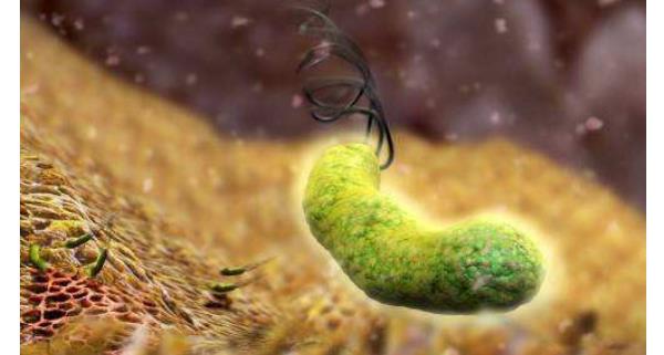  幽门螺杆菌二次感染几率，如何预防复发？