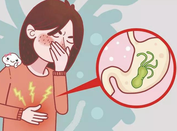 幽门螺杆菌早期症状你知道吗？