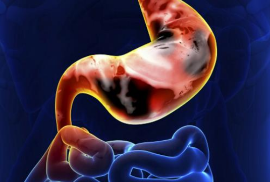 胃炎的症状有哪些表现？具体的危害还有什么