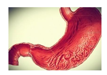 慢性胃炎能彻底治愈吗，胃炎，慢性萎缩性  有一些可以逆转。